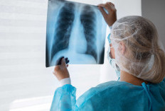 Jepang Wajibkan Tes Tuberkolusis Warga Asing, Termasuk Indonesia