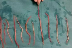Bocah 3 Tahun di Sukabumi Meninggal dengan Tubuh Dipenuhi Cacing, Soroti Krisis Kesehatan dan Lingkungan
