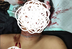 Pria Misterius Kecelakaan di Warkuk Ranau Selatan, Dilarikan ke Puskesmas