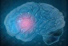 Waspada Stroke: Kenali Gejala, Penyebab, dan Cara Pencegahannya